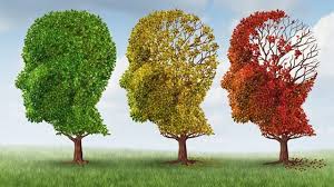 Неврологи предложили новый способ лечения болезни Альцгеймера
