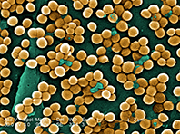Биологи нашли слабое место у супербактерии золотистого стафилококка