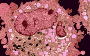 Израильские ученые нашли «ахиллесову пяту» большинства раковых клеток