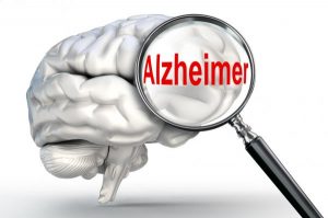 Российские ученые нашли спасение от болезни Альцгеймера
