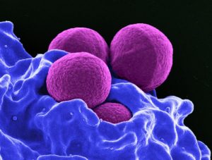 Перенастройка иммунного ответа побеждает устойчивый к антибиотикам стафилококк