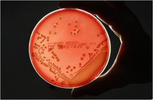 Растяжение метициллин-устойчивых бактерий 
