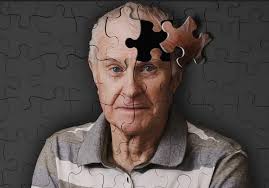 Болезнь Альцгеймера - неизлечимое нейродегенеративное заболевание