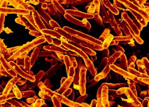 Клеточную стенку возбудителя туберкулеза сломали дефицитом витамина B7