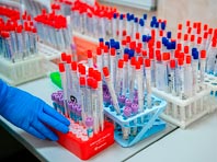 В России будет широко доступно тестирование на коронавирус