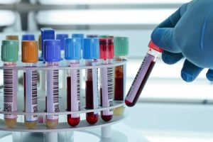 FDA запускает национальную программу по разработке препаратов крови для лечения COVID-19