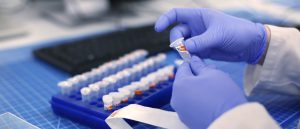 Открытие специализированной лаборатории Centogene позволит увеличить масштабы тестирования COVID-19