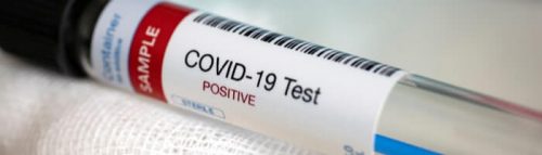 Тест-система «Система-БиоТех» позволит выявить коронавирус за 15 минут