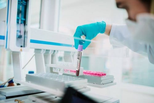 В России зарегистрирована тест-система для определения количества антител к коронавирусу