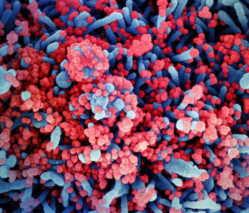 Исследование: мутировавший коронавирус может научиться проникать в клетки новым способом