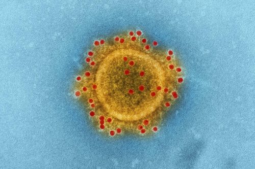 Израильские учёные совершили открытие, уничтожив коронавирус всего за две секунды