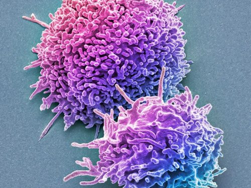 Иммунные «клетки-убийцы» все еще распознают штамм Омикрон