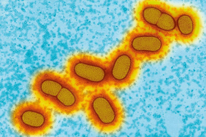 Бактерии Porphyromonas gingivalis (P. gingivalis)