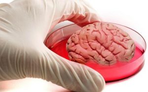 Израильские ученые создали имплантат спинного мозга из жира человека