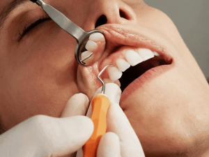 Оказалось что COVID-19 влияет на здоровье зубов и дёсен