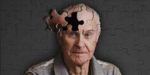 процесс болезни Альцгеймера в головном мозгу