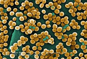 Открыт способ уничтожить устойчивую к антибиотикам самую опасную в мире  бактерию