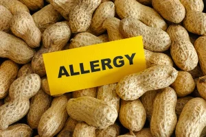Разработан пластырь от аллергии на арахис у детей