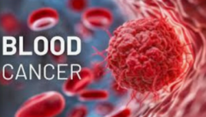 Найден новый безопасный метод лечения рака крови